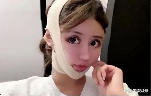 全身整形的网红,网红全身整形之旅揭秘